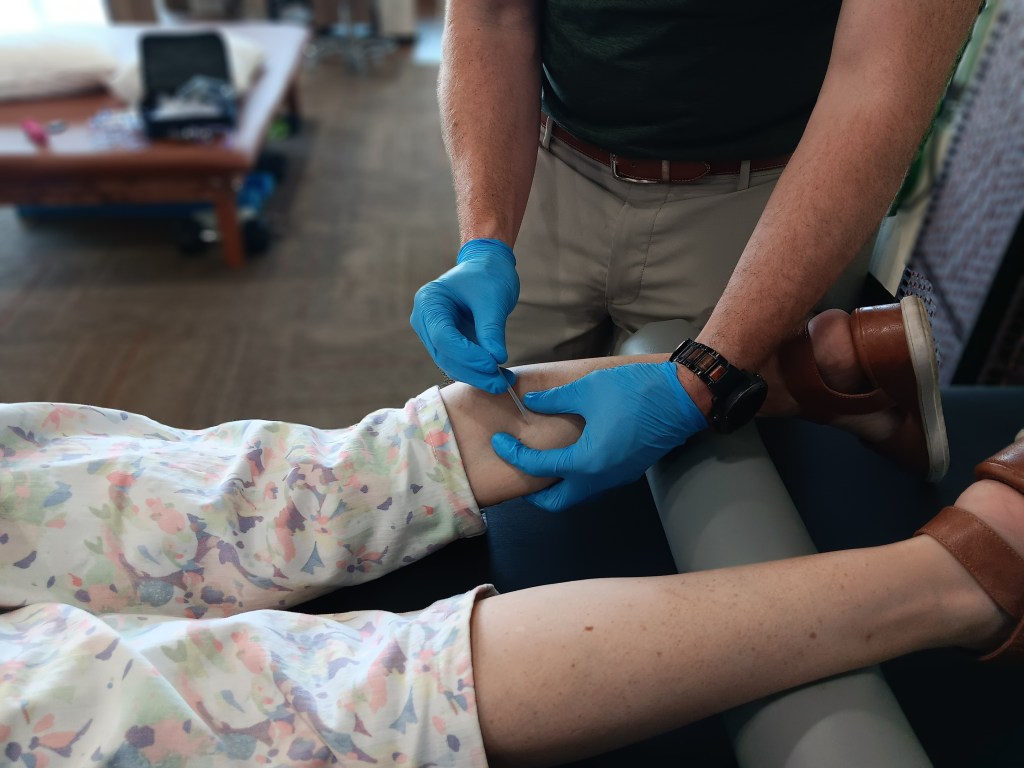 Unveiling the Magic of Dry Needling: Your Path to Pain Relief and Improved Muscle&nbsp;Fitness