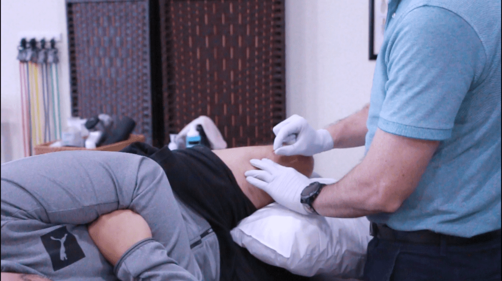 Dry Needling in Acworth and Dallas GA: Salisbury Physical&nbsp;Therapy